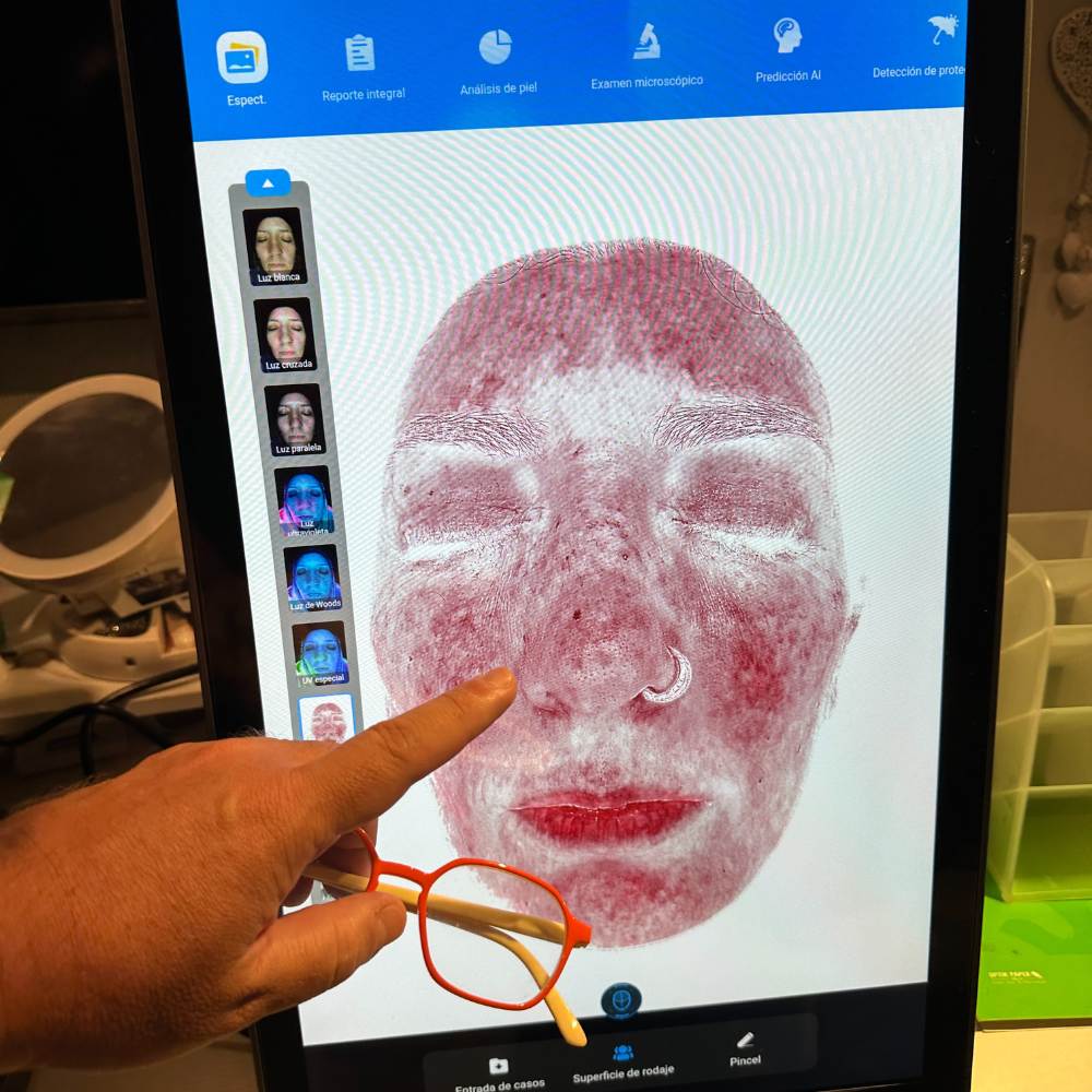 X5 PRO DETECTION MISTIK