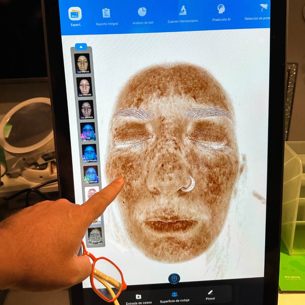 X5 PRO DETECTION MISTIK