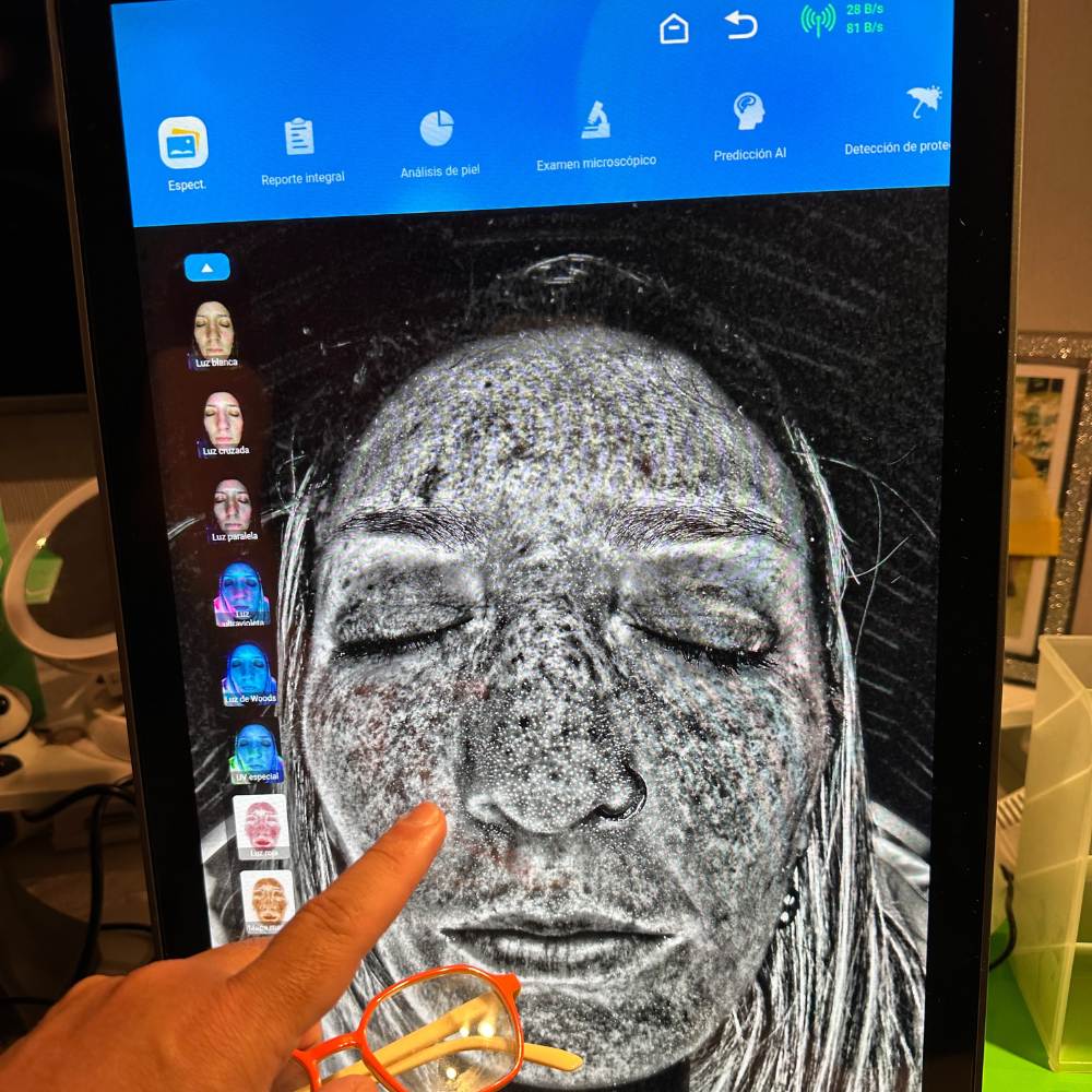 X5 PRO DETECTION MISTIK